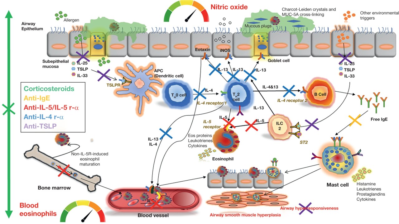 Choosing the Right Biologic for the Right Patient With Severe Asthma ...