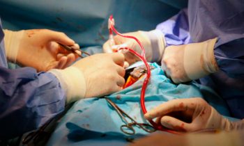 Incorporating intraoperative blood pressure time-series variables to assist in prediction of acute kidney injury after type a acute aortic dissection repair: an interpretable machine learning model