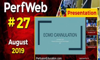 ECMO cannulation. Extracorporeal Membrane Oxygenation.