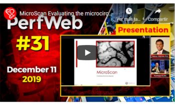 MicroScan Evaluating the microcirculation on Cardiopulmonary Bypass CPB