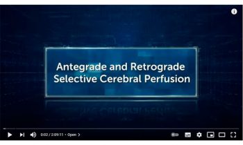 Antegrade and Retrograde Selective Cerebral Perfusion.
