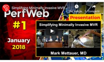 Simplifying Minimally Invasive MVR – Minimally Invasive Mitral Valve Surgery.