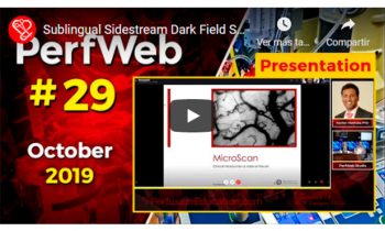 Sublingual Sidestream Dark Field SDF Imaging.