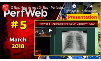X Ray. How to read X- Ray.