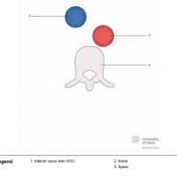 Situs solitus; short axis of aorta and inferior caval vein