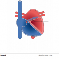 Unroofed coronary sinus