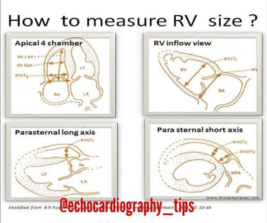 measure RV size