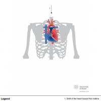 Mesoposition