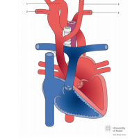 Right cervical arch