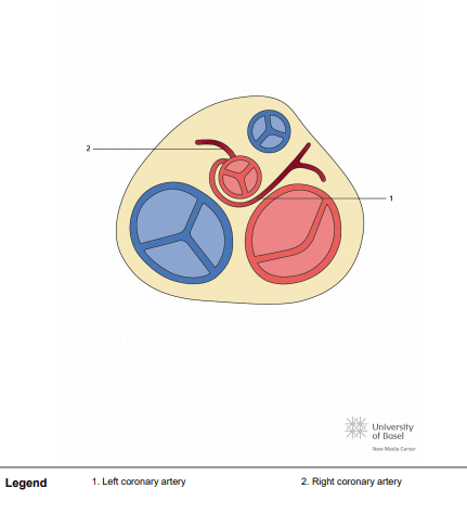 Single right coronary ostium with posterior course of the left coronary artery (LAD)