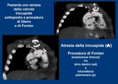 fontan1