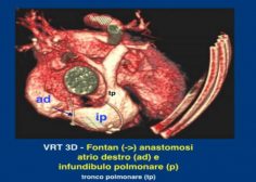 fontan2