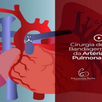 Bandagem da artéria pulmonar – Pulmonary artery banding