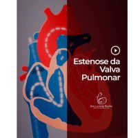 Estenose da Valva Pulmonar – Pulmonary valve stenosis