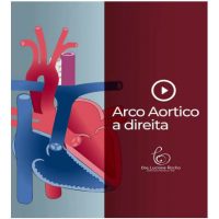 Arco aortico a direita – Aortic arch on the right