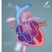 Tronco arterial comum ou Truncus